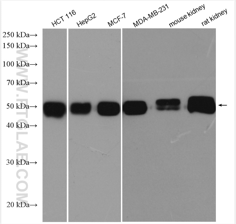 Western Blot (WB) analysis of various lysates using EBP50/NHERF-1 Polyclonal antibody (29771-1-AP)