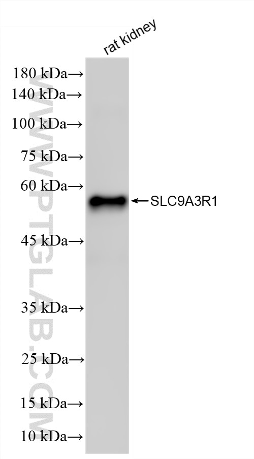 rat kidney tissue were subjected to SDS PAGE followed by western blot with 87174-1-RR (SLC9A3R1 antibody) at dilution of 1:40000 incubated at room temperature for 1.5 hours. This data was developed using the same antibody clone with 87174-1-PBS in a different storage buffer formulation. Western Blot (WB) analysis of rat kidney tissue using EBP50/NHERF-1 Recombinant monoclonal antibody (87174-1-RR)