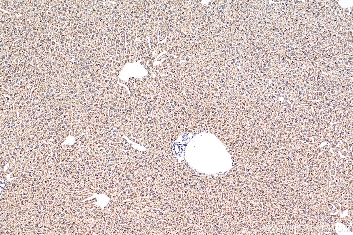 IHC staining of mouse liver using 17904-1-AP