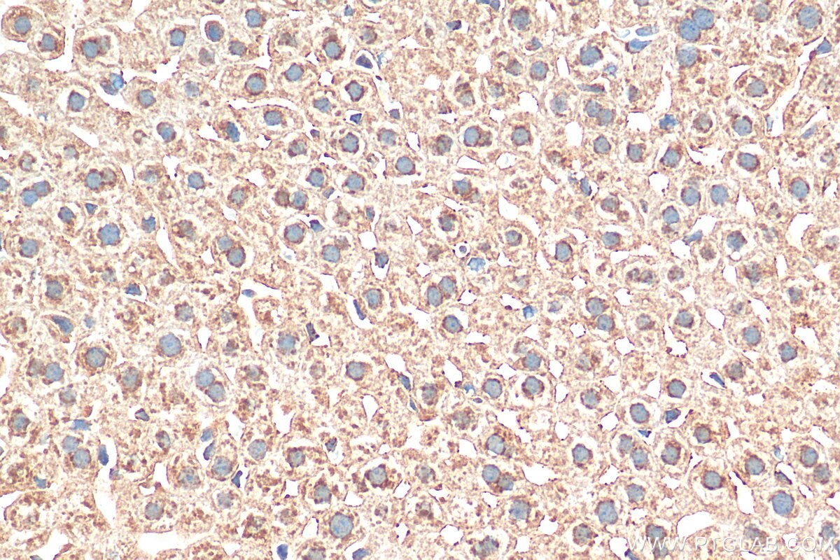 Immunohistochemistry (IHC) staining of mouse liver tissue using EBPL Polyclonal antibody (17904-1-AP)