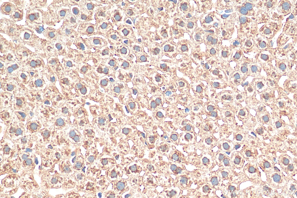 IHC staining of mouse liver using 17904-1-AP