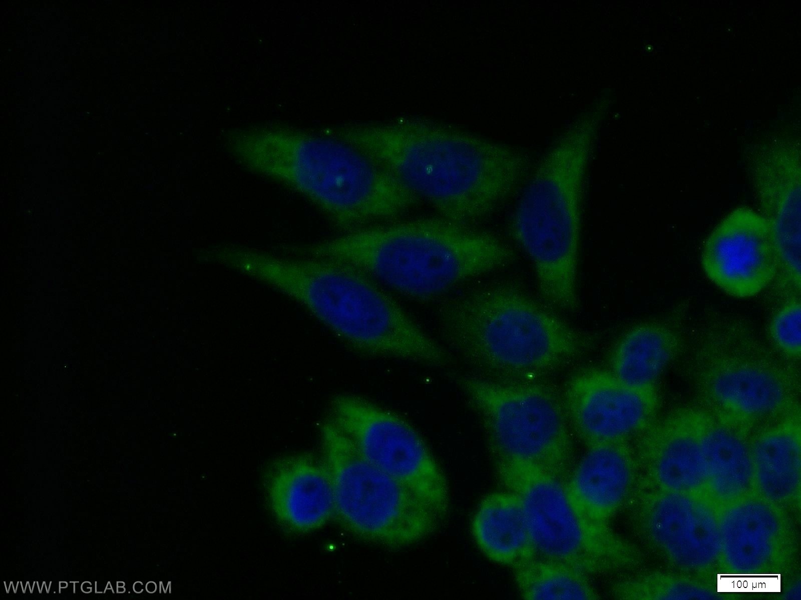 Immunofluorescence (IF) / fluorescent staining of HeLa cells using ECD Polyclonal antibody (10192-1-AP)