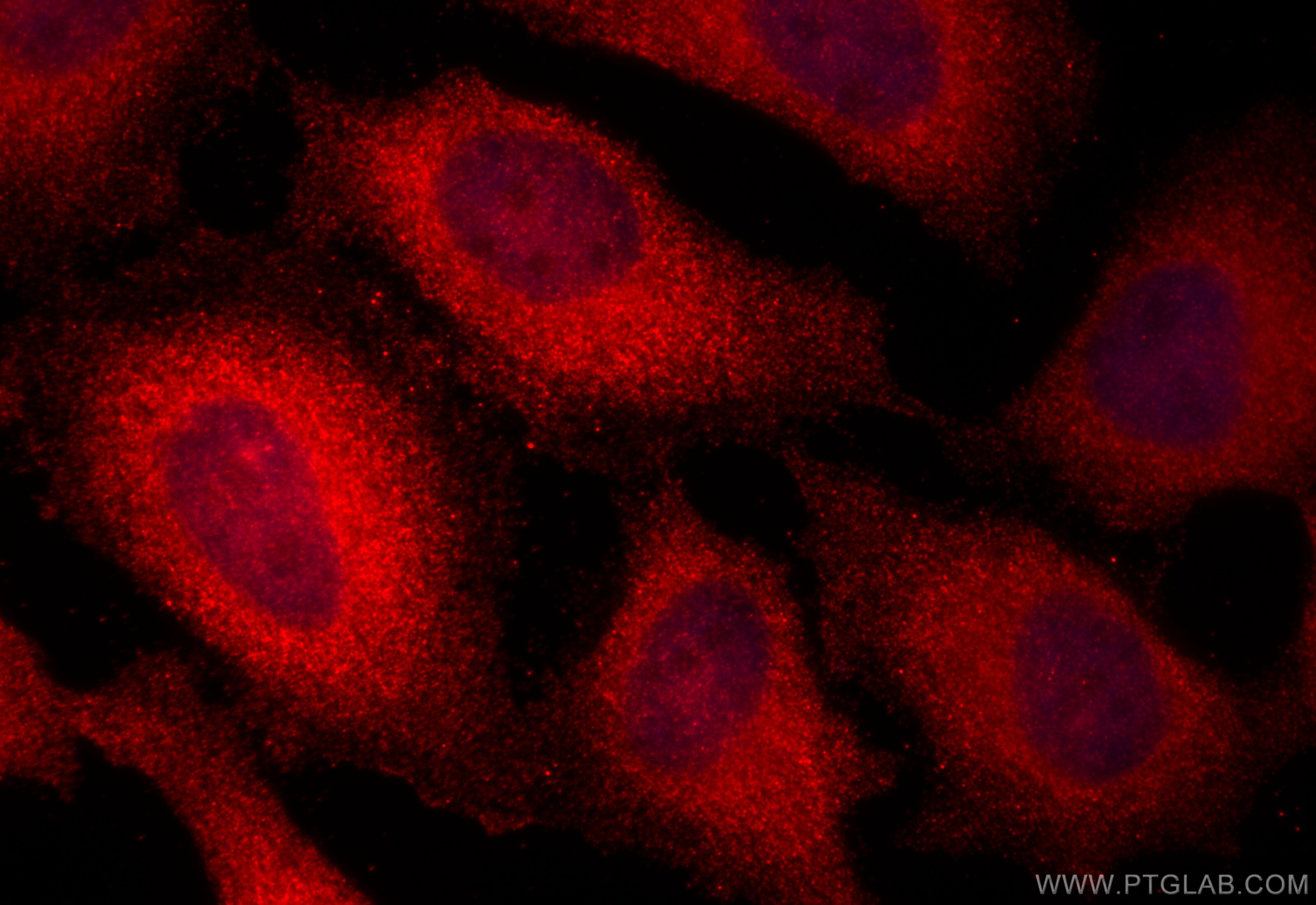 Immunofluorescence (IF) / fluorescent staining of HeLa cells using ECD Polyclonal antibody (10192-1-AP)