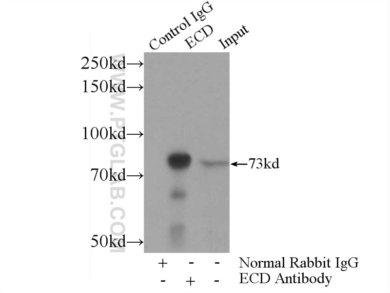 Immunoprecipitation (IP) experiment of HeLa cells using ECD Polyclonal antibody (10192-1-AP)