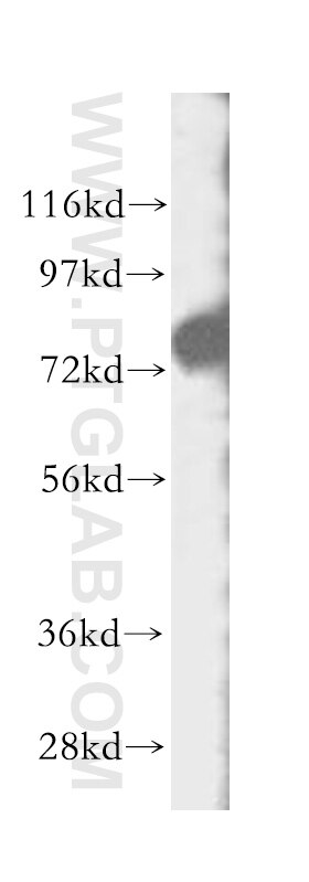 Western Blot (WB) analysis of HeLa cells using ECD Polyclonal antibody (10192-1-AP)