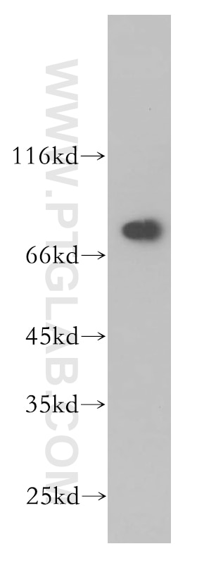 Western Blot (WB) analysis of HeLa cells using ECD Polyclonal antibody (10192-1-AP)