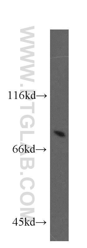 WB analysis of HeLa using 10192-1-AP