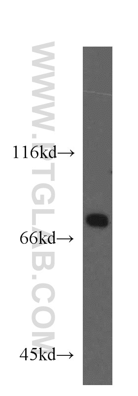 Western Blot (WB) analysis of HeLa cells using ECD Polyclonal antibody (10192-1-AP)