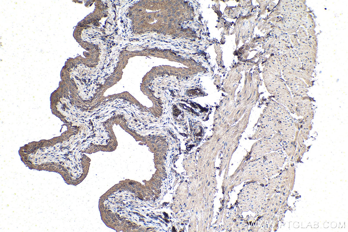 IHC staining of mouse bladder using 67179-1-Ig
