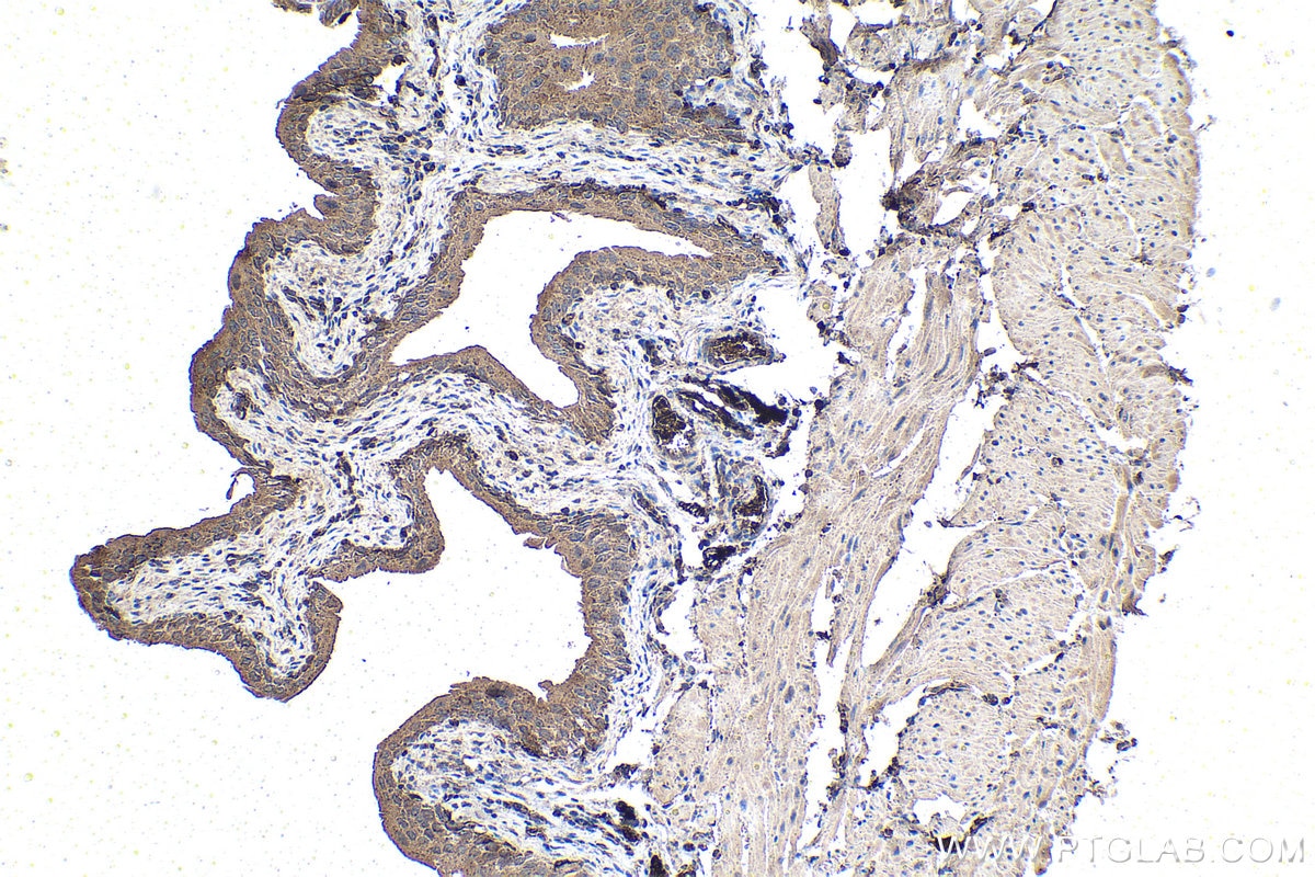 Immunohistochemistry (IHC) staining of mouse bladder tissue using ECD Monoclonal antibody (67179-1-Ig)