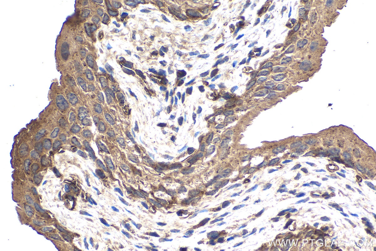 Immunohistochemistry (IHC) staining of mouse bladder tissue using ECD Monoclonal antibody (67179-1-Ig)