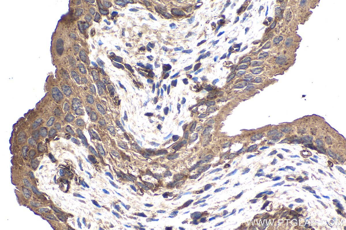 IHC staining of mouse bladder using 67179-1-Ig