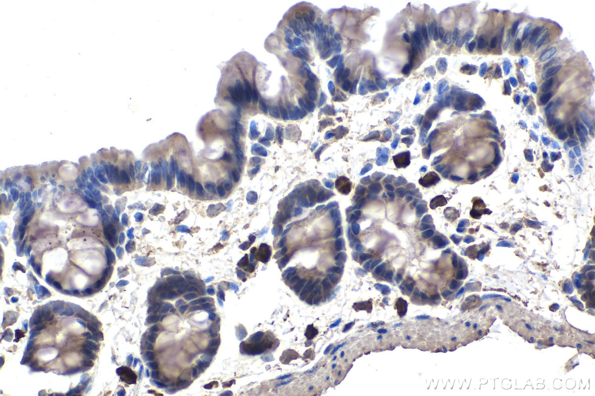 Immunohistochemistry (IHC) staining of rat colon tissue using ECD Monoclonal antibody (67179-1-Ig)