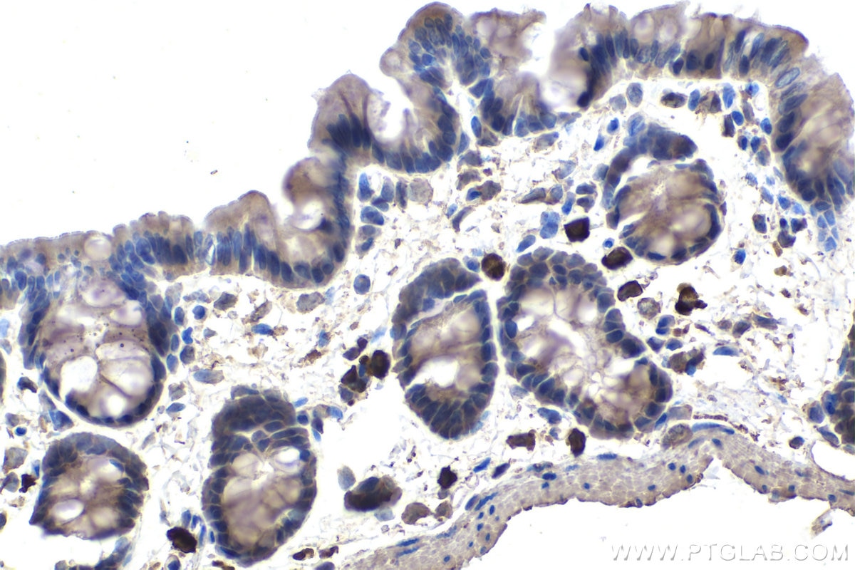 IHC staining of rat colon using 67179-1-Ig