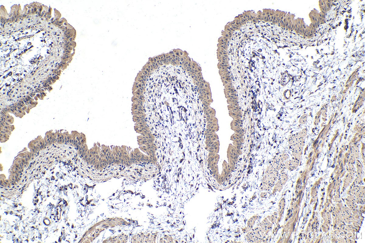 Immunohistochemistry (IHC) staining of rat bladder tissue using ECD Monoclonal antibody (67179-1-Ig)