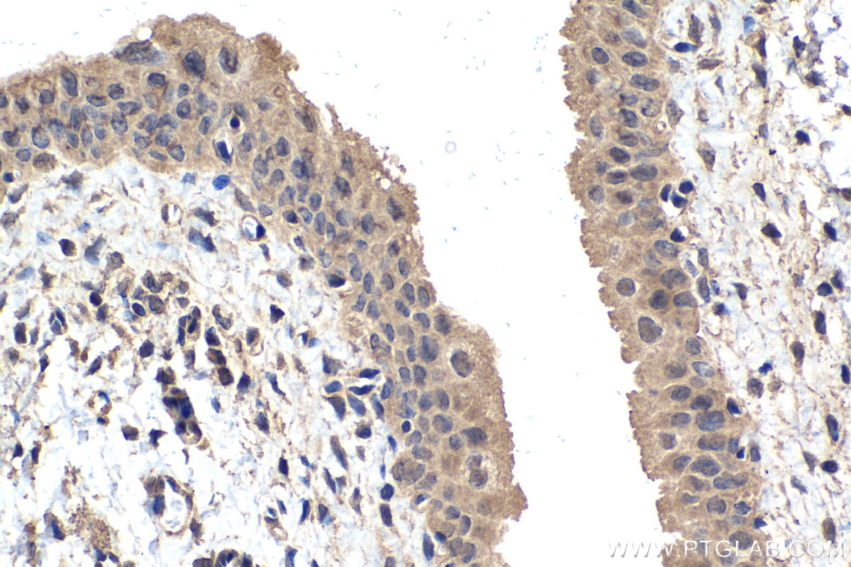 Immunohistochemistry (IHC) staining of rat bladder tissue using ECD Monoclonal antibody (67179-1-Ig)