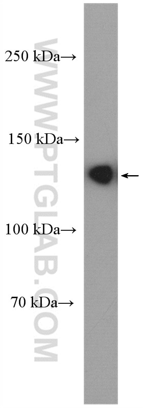 Western Blot (WB) analysis of A549 cells using ECE1 Polyclonal antibody (26088-1-AP)