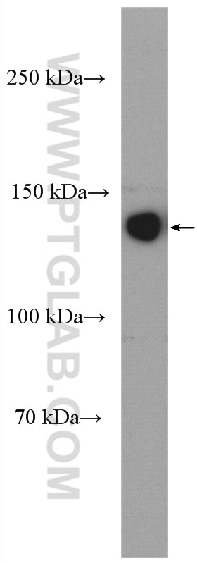 Western Blot (WB) analysis of HeLa cells using ECE1 Polyclonal antibody (26088-1-AP)