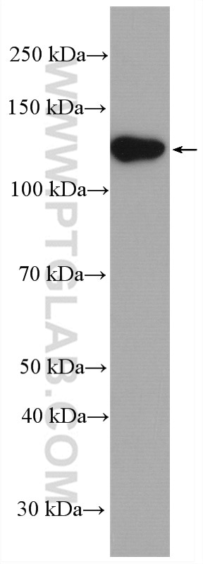 Western Blot (WB) analysis of various lysates using ECE1 Polyclonal antibody (26088-1-AP)