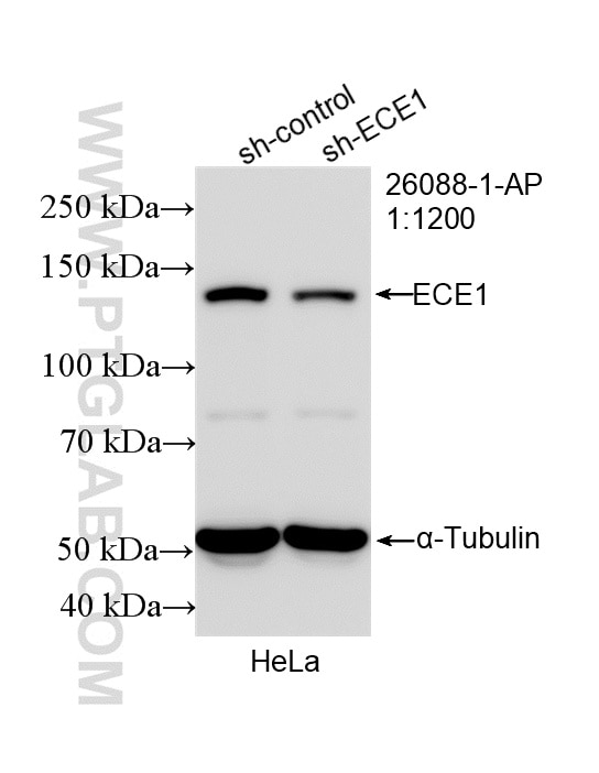 WB analysis of HeLa using 26088-1-AP Western Blot (WB) analysis of HeLa cells using ECE1 Polyclonal antibody (26088-1-AP)
