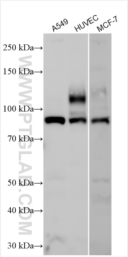 Western Blot (WB) analysis of various lysates using ECE1 Polyclonal antibody (27245-1-AP)