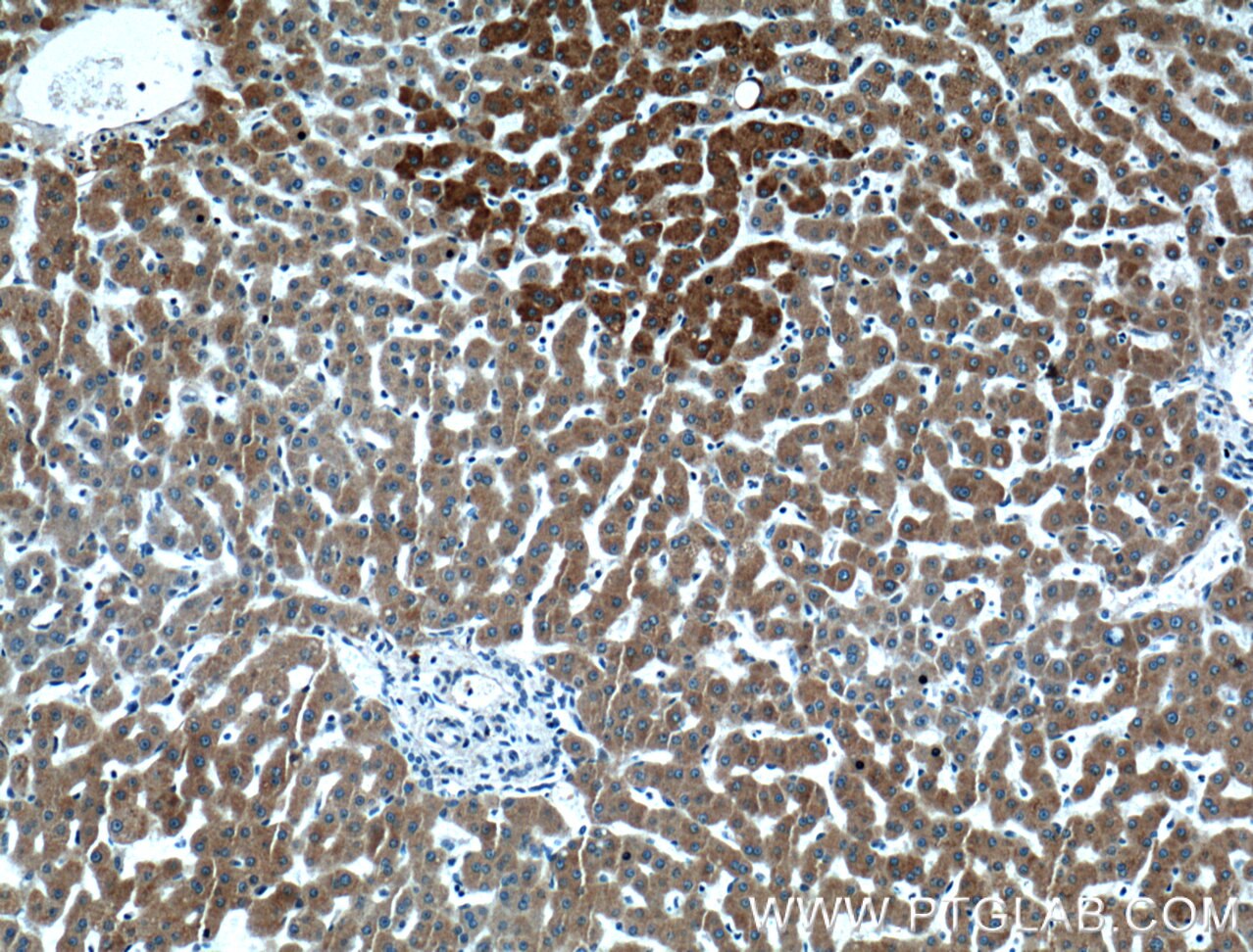 Immunohistochemistry (IHC) staining of human liver tissue using ECE2 Polyclonal antibody (15418-1-AP)