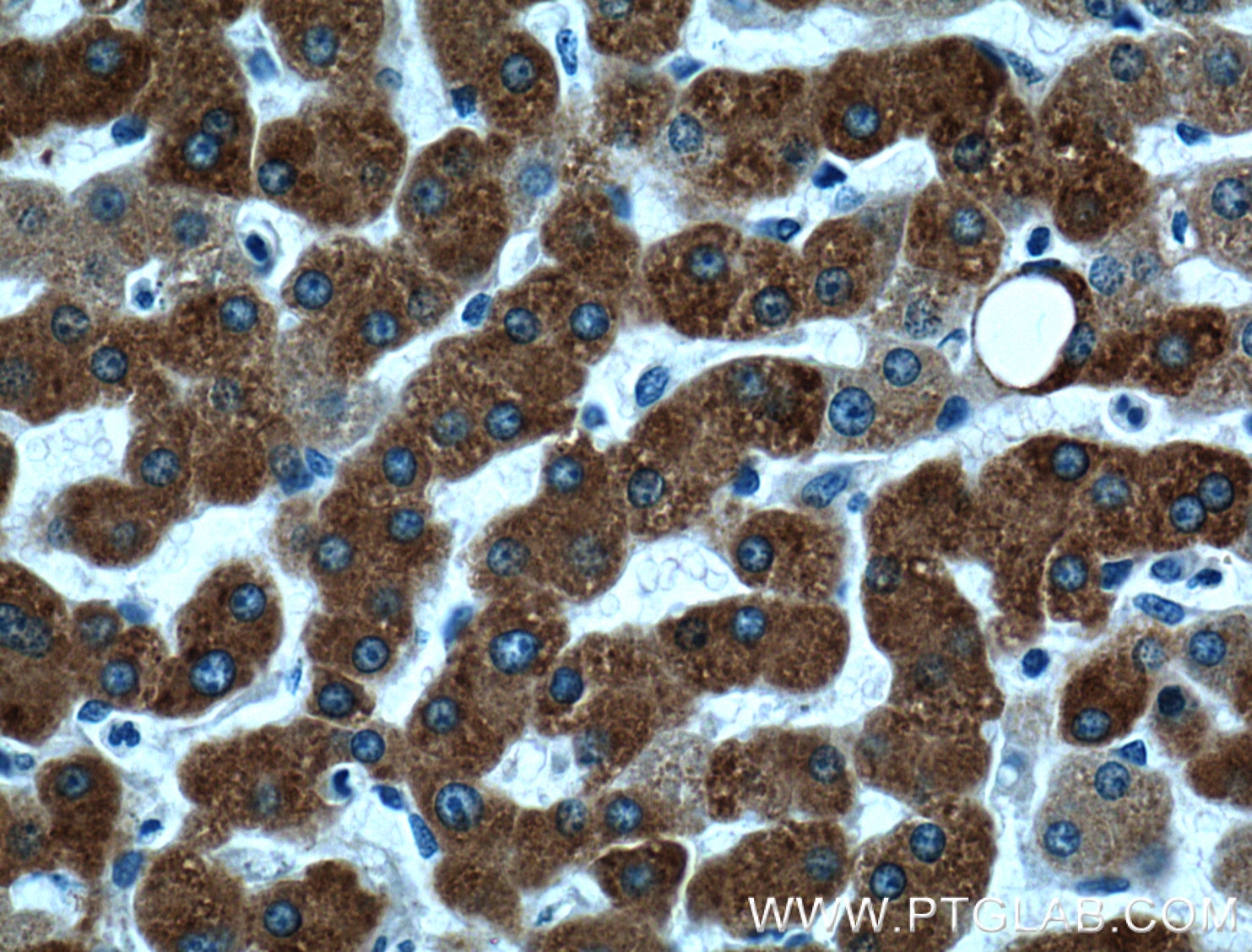 Immunohistochemistry (IHC) staining of human liver tissue using ECE2 Polyclonal antibody (15418-1-AP)