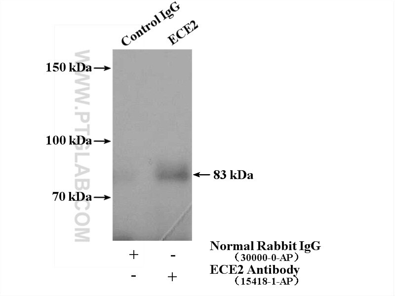 Immunoprecipitation (IP) experiment of mouse liver tissue using ECE2 Polyclonal antibody (15418-1-AP)