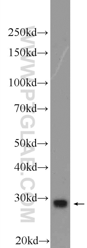 Western Blot (WB) analysis of mouse liver tissue using EEF1AKMT4 Polyclonal antibody (15418-1-AP)