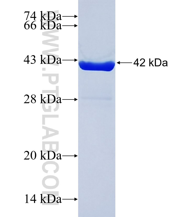 ECE2 fusion protein Ag37529 SDS-PAGE