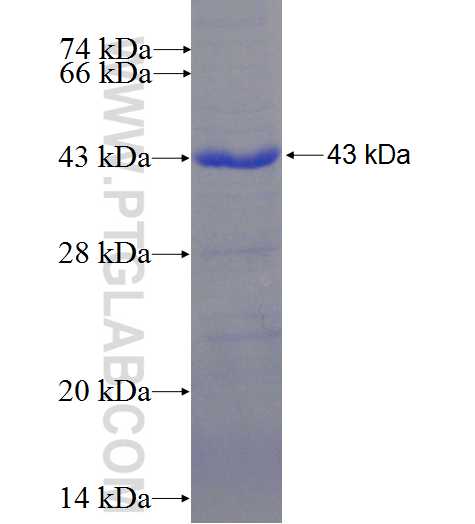 ECEL1 fusion protein Ag5577 SDS-PAGE