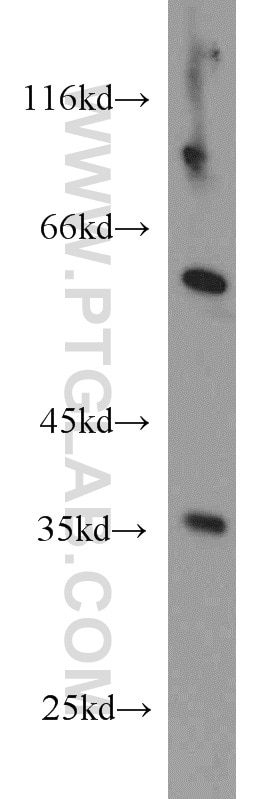 Western Blot (WB) analysis of Jurkat cells using ECH1 Polyclonal antibody (11385-1-AP)