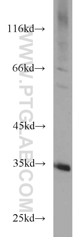 Western Blot (WB) analysis of HepG2 cells using ECH1 Polyclonal antibody (11385-1-AP)