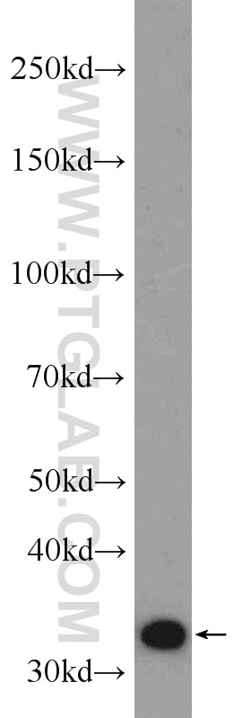 WB analysis of mouse heart using 11385-1-AP