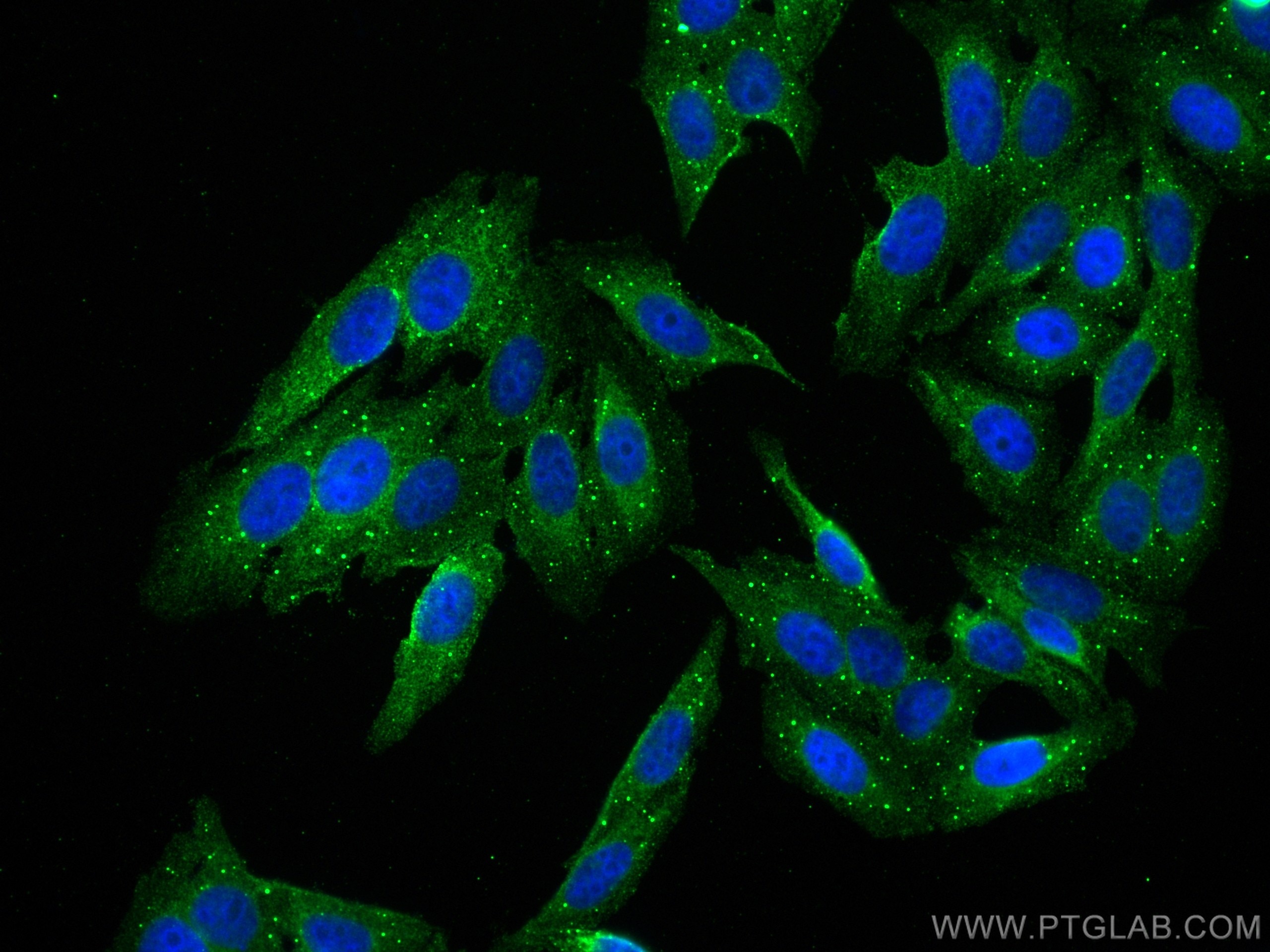 Immunofluorescence (IF) / fluorescent staining of HepG2 cells using ECH1 Monoclonal antibody (68139-1-Ig)