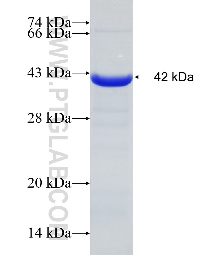 ECH1 fusion protein Ag32661 SDS-PAGE