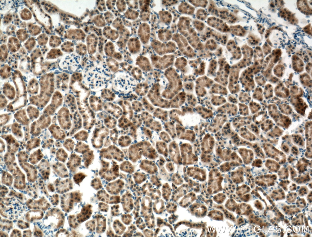 IHC staining of mouse kidney using 27732-1-AP