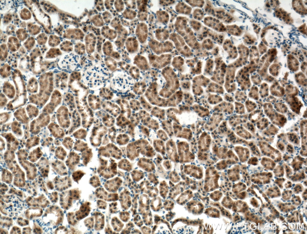 Immunohistochemistry (IHC) staining of mouse kidney tissue using ECHDC1 Polyclonal antibody (27732-1-AP)