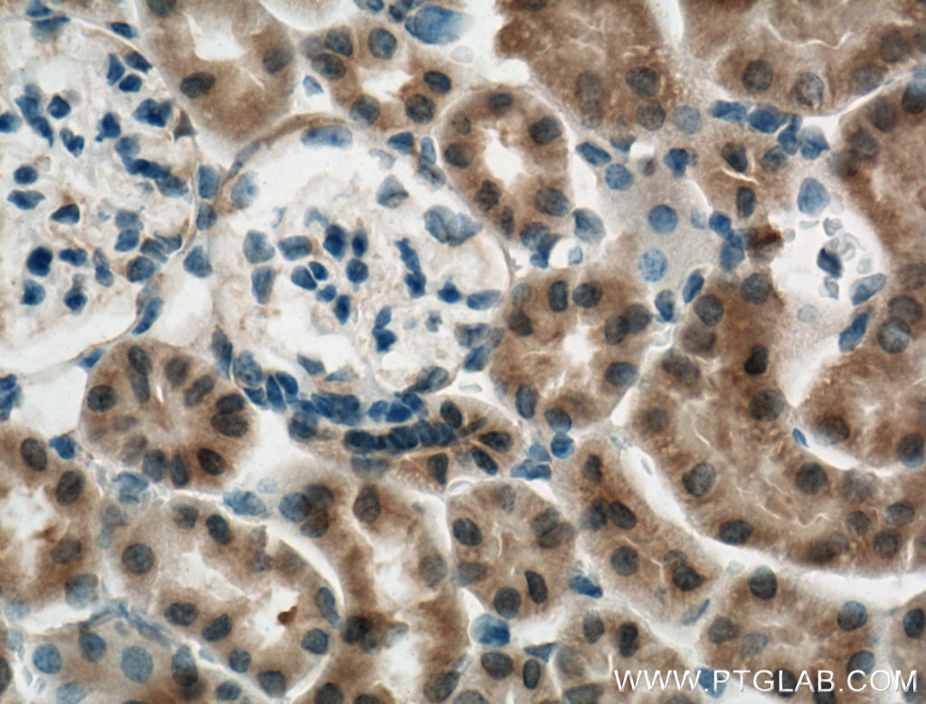 Immunohistochemistry (IHC) staining of mouse kidney tissue using ECHDC1 Polyclonal antibody (27732-1-AP)