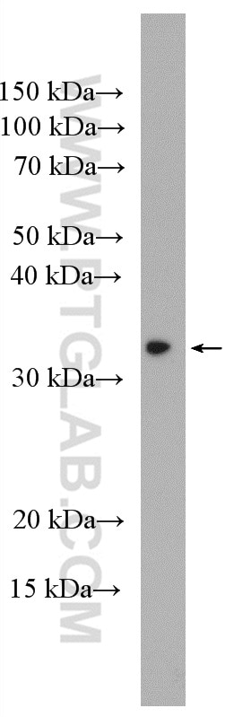 Western Blot (WB) analysis of A549 cells using ECHDC1 Polyclonal antibody (27732-1-AP)
