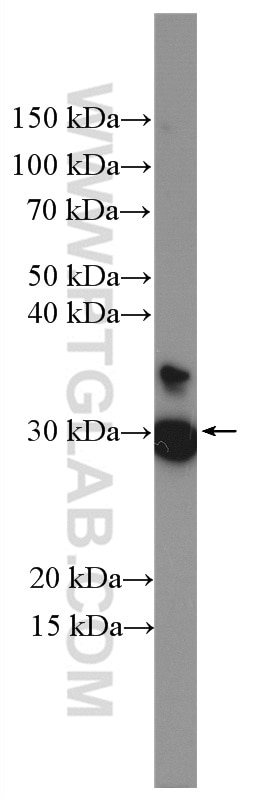 Western Blot (WB) analysis of PC-12 cells using ECHDC1 Polyclonal antibody (27732-1-AP)