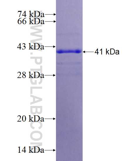 ECHDC1 fusion protein Ag26905 SDS-PAGE