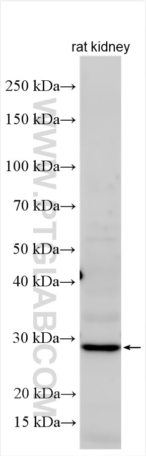 Western Blot (WB) analysis of various lysates using ECHDC2 Polyclonal antibody (26126-1-AP)