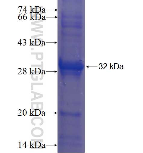 ECHDC2 fusion protein Ag23510 SDS-PAGE