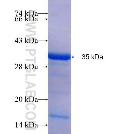 ECHDC3 fusion protein Ag25707 SDS-PAGE