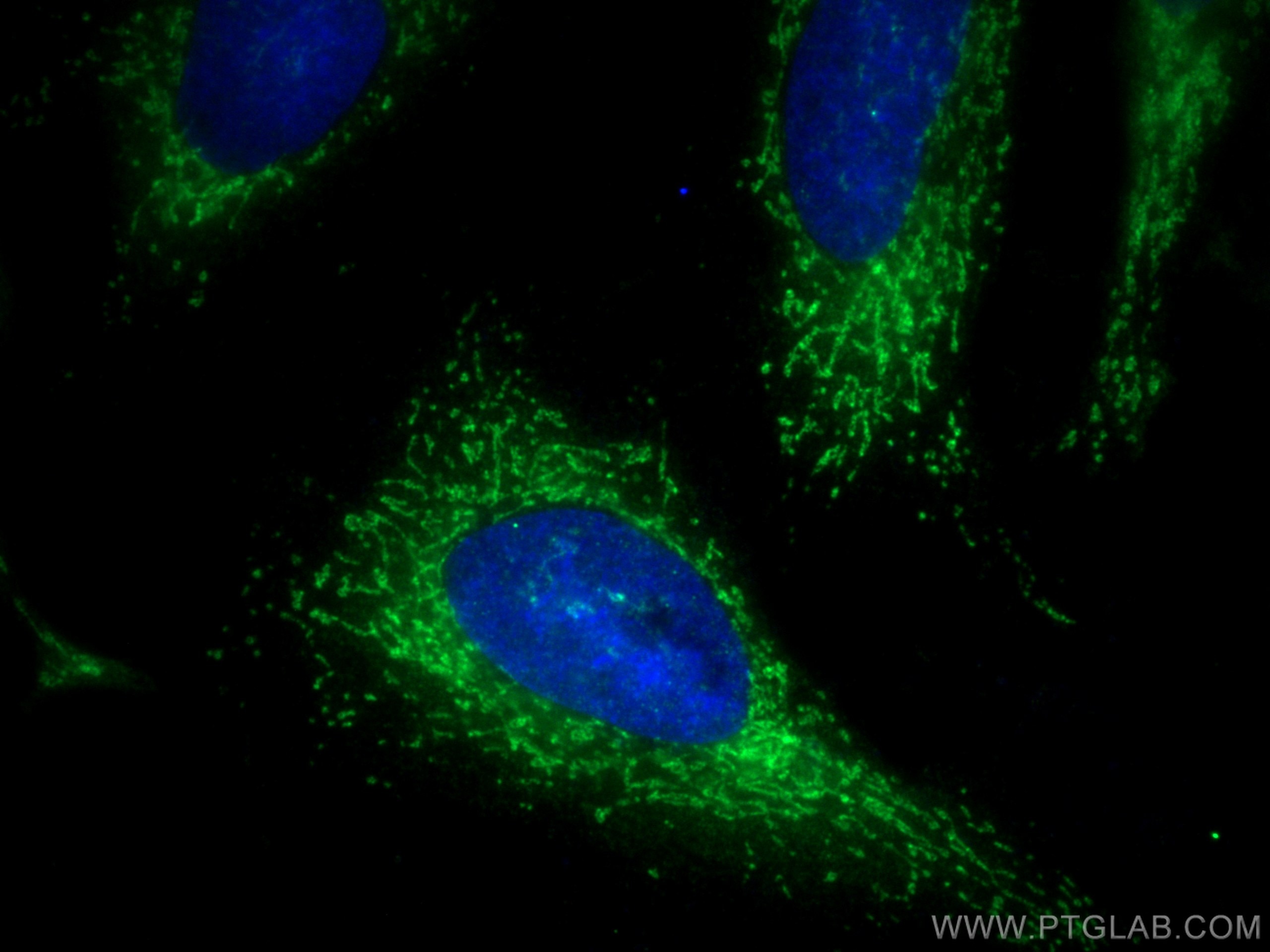 Immunofluorescence (IF) / fluorescent staining of HeLa cells using ECHS1 Polyclonal antibody (11305-1-AP)