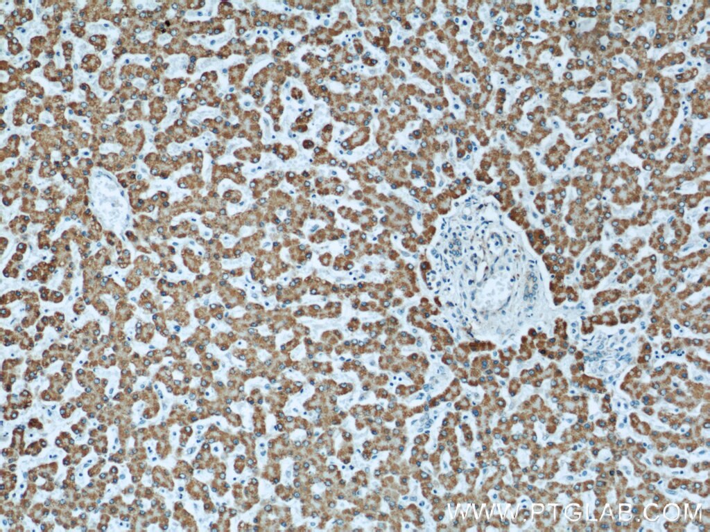 Immunohistochemistry (IHC) staining of human liver tissue using ECHS1 Polyclonal antibody (11305-1-AP)