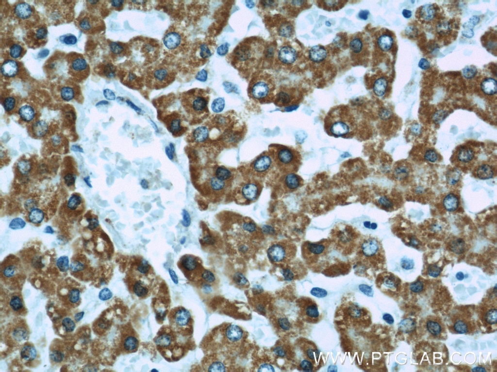 Immunohistochemistry (IHC) staining of human liver tissue using ECHS1 Polyclonal antibody (11305-1-AP)