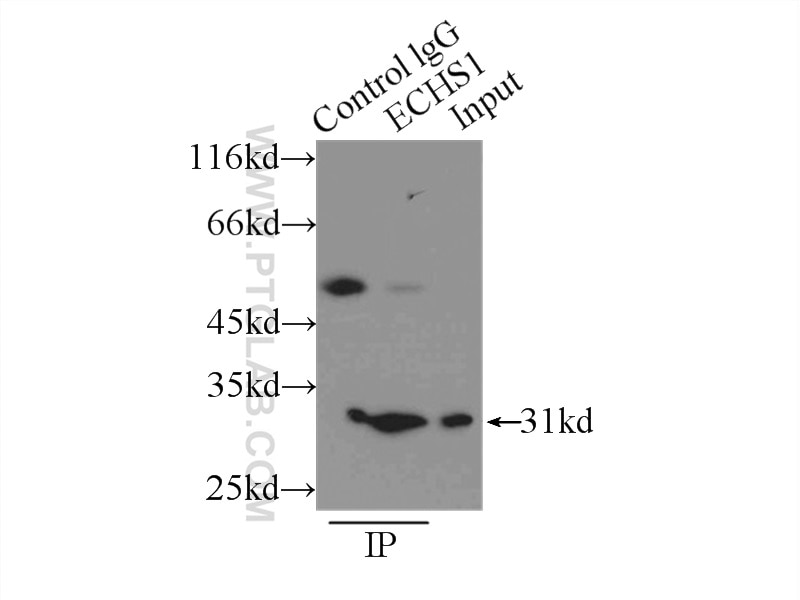 Immunoprecipitation (IP) experiment of PC-3 cells using ECHS1 Polyclonal antibody (11305-1-AP)