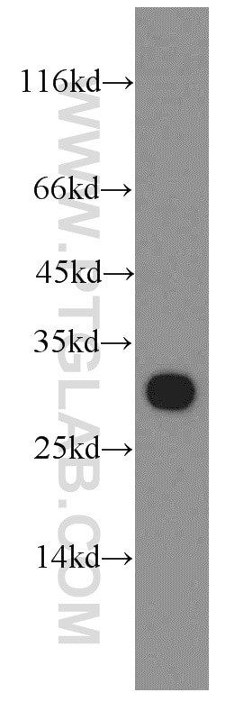 Western Blot (WB) analysis of HeLa cells using ECHS1 Polyclonal antibody (11305-1-AP)